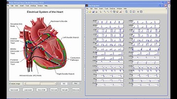 VHM v2.0 Electrogram simulation