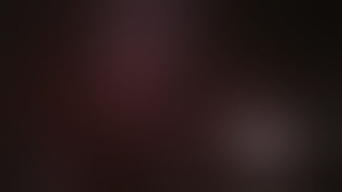 Laparoscopic Cholangiogram by Dr.Amr Hassan