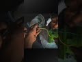 "Splendor BS6 Injector Cleaning | Bike Missing Problem Solution 🔧"