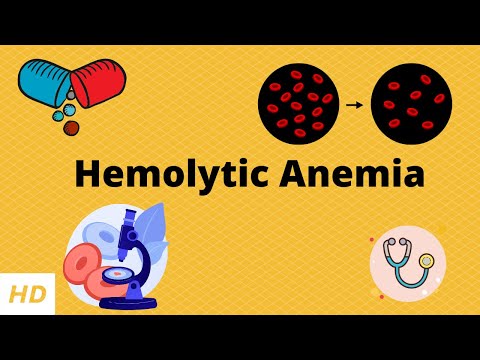 Hemolytic Anemia, Causes, Signs and Symptoms, Diagnosis and Treatment.