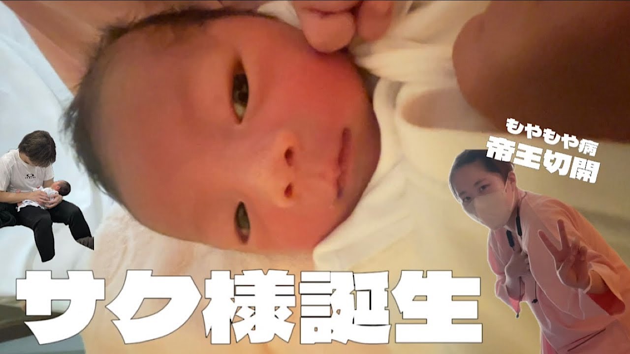 【出産】26歳モヤモヤ病ついに母親になりました🤱