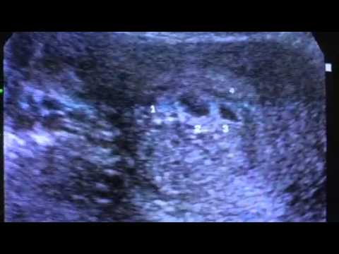博元婦產科試管嬰兒