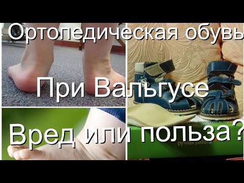 Ортопедическая обувь при вальгусе. Вред или польза? Мнение врача остеопата.