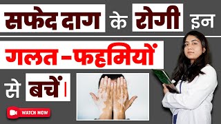 Myths and Facts About Vitiligo in Hindi | Vitiligo is Contagious Disease (Myths and Facts)