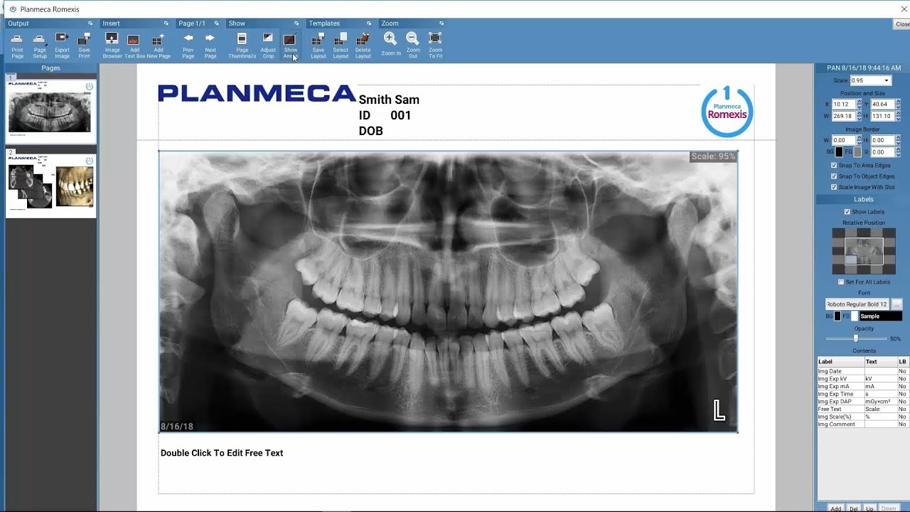 Planmeca Romexis print editor
