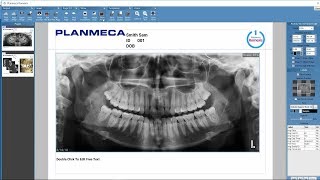 Planmeca Romexis print editor