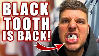 PRANKMAS: THE BLACK TOOTH IS BACK!