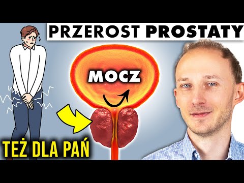 Wideo: Jak radzić sobie z powiększoną prostatą: 9 kroków (ze zdjęciami)