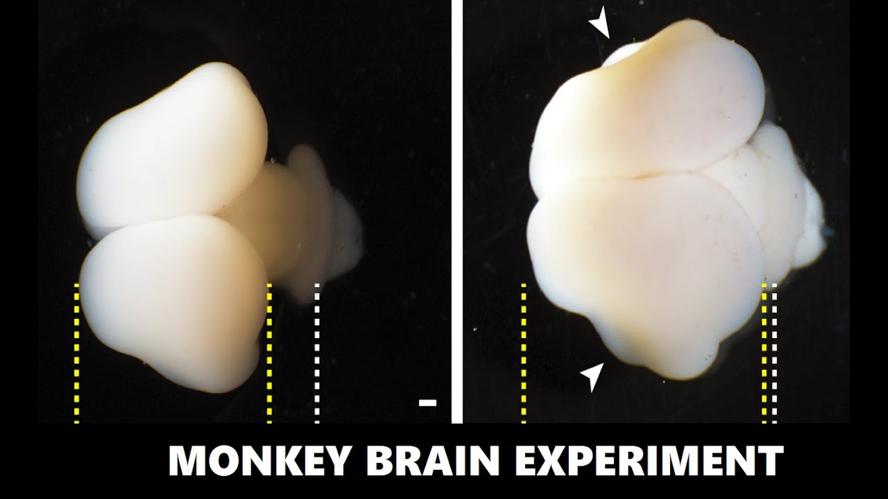 Human Gene in Monkey Brains: Scientists Make Monkey Brains Bigger