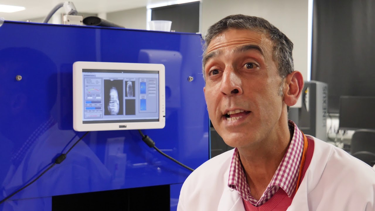 The research aiming to detect rheumatoid arthritis earlier - YouTube