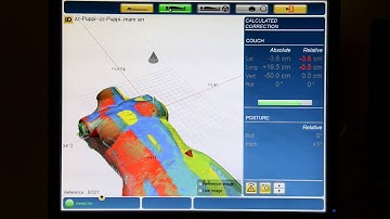 cPosition software (C-Rad Catalyst HD)