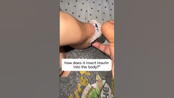 HOE DE TUBELESS INSULINEPOMP WERKT! #OMNIPOD #T1DTODDLER