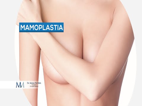 Dr. Moises De Melo | Mamoplastia