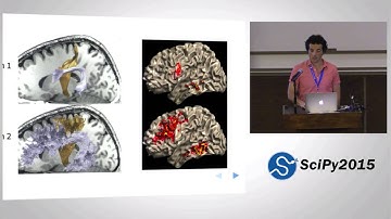 Statistical Learning of Human Brain Structure in DIPY | SciPy 2015 | Ariel Rokem, Franco Pestilli, B