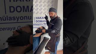 4 Yıllık Saç Simülasyonu Işlemi Iletişim 0535 697 95 19 İstanbul Şişli