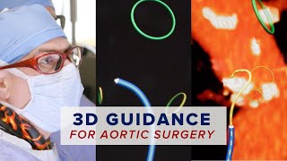 Pioneering New 3D Guidance for Aortic Surgery: Fiber Optic RealShape (FORS) Technology