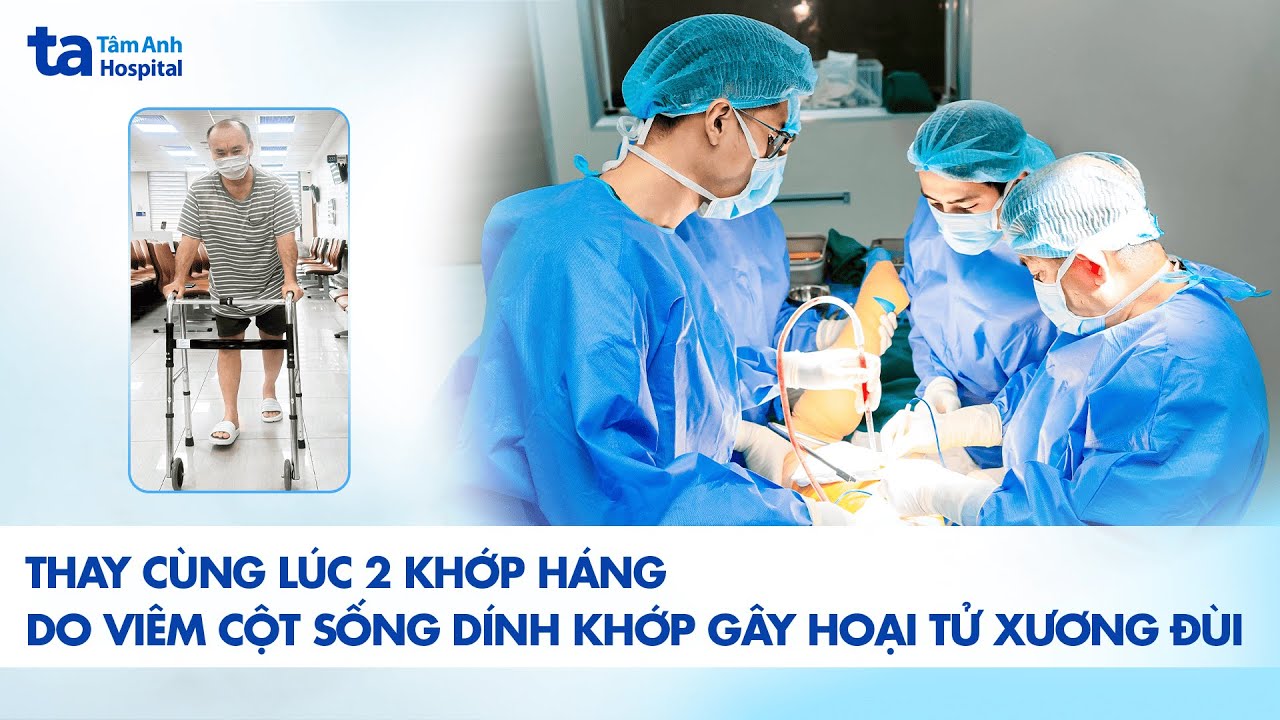 Thay cùng lúc 2 khớp háng do viêm cột sống dính khớp gây hoại tử xương đùi | BVĐK Tâm Anh