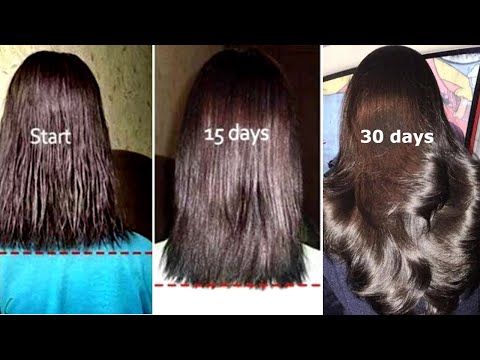 बालों को तेजी से कैसे बढ़ाये - Use This Secret DIY For Fast Hair Growth - Priya Malik - 동영상