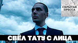 Рэпер Face свёл с лица все татуировки.