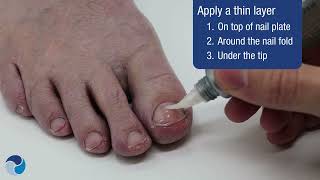 How To Apply Tolcylen Anti-Fungal