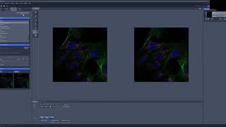 Airyscan Fast Imaging Operating Inverted Zeiss Lsm 880 Microscope Using Zen 2.3 Sp1 App.