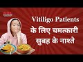 Follow this special breakfast diet for faster recovery if youre vitiligo patient  drnitika kohli