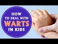 How to Deal With Warts In Children