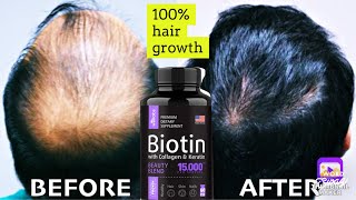Biotin HAIR supplement WITH collagen AND keratin boost HAIR growth HEALTHY nails AND skin
