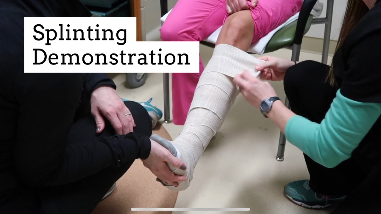 How To Apply Fiberglass Splint Splinting Demonstration YouTube How To Apply Fiberglass Splint Splinting Demonstration YouTube