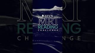 Routine Degeneration or Spinal Infection? MRI Reading Challenge