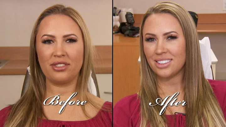 Wife of Hot Felon Jeremy Meeks Gets Smile Makeover