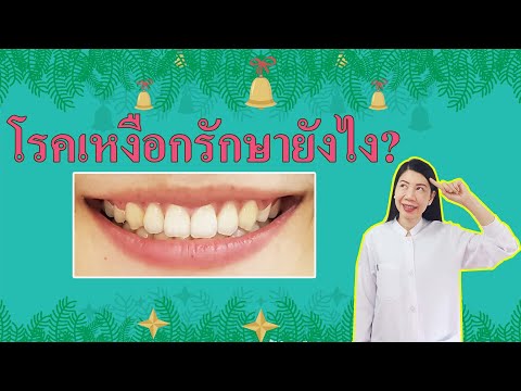 โรคเหงือกรักษายังไง?