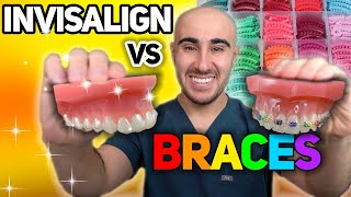 Braces vs Invisalign: Cost, Tooth Pain, Speed, etc - The ULTIMATE Review 🔥