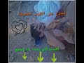 ضحك وبكاء مع طبيب الاسنان ضحك وبكاء مع طبيب الاسنان