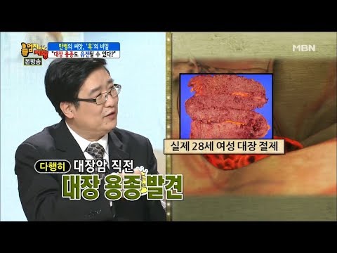 대장암으로 진행될 수 있는 대장용종, 예방법은? [엄지의 제왕 119회]