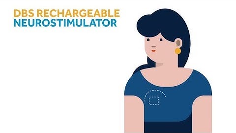 Medtronic DBS Wireless Recharger for Activa™ RC devices - How to Use Animation