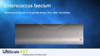 Enterococcus faecium