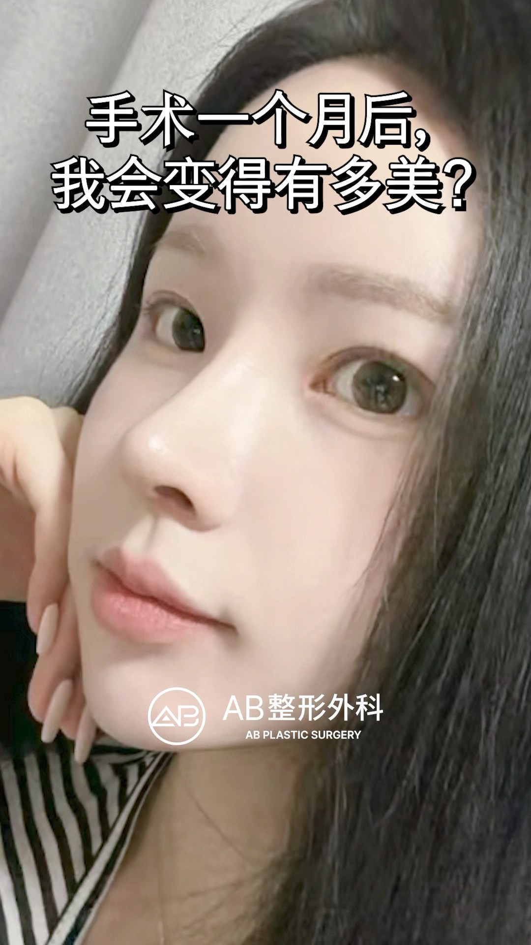 1個月後的驚人變化｜前後對照 #shorts
