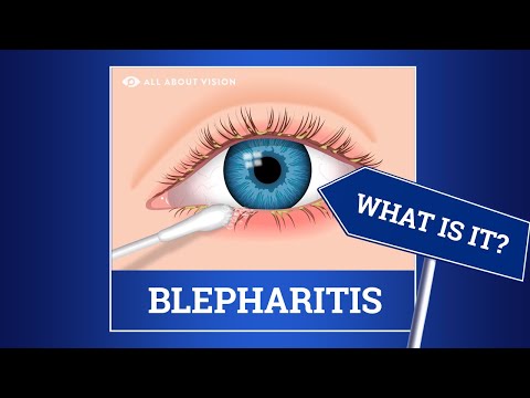 Blepharitis (red swollen eyelids): Causes, Symptoms, Treatments