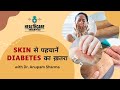 12 Skin Signs You Might Have Diabetes – Dr. Anupam Explains in Simple Words