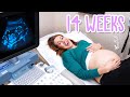 14 Week Pregnancy Ultrasound - Baby Moving and Yawning!