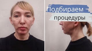 КОСМЕТОЛОГ против ХИРУРГА 2 / Подбираем ПРОЦЕДУРЫ для подписчицы  / #бьютикуратор