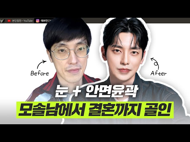 소개팅 성공→결혼! 맥미남 홍민기의 리얼 성형 후기ㅣ디에이성형외과ㅣ디에이성형외과의원