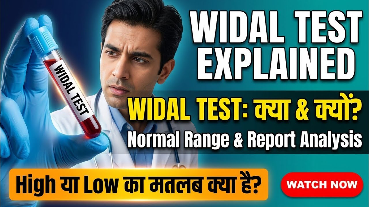 Widal Test Normal Report Format Widal Test Explained 🔬 | Typhoid Blood Test Normal Range & Report ...