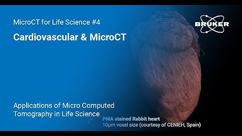 Cardiovascular & MicroCT | Applications of MicroCT in Life Science #4