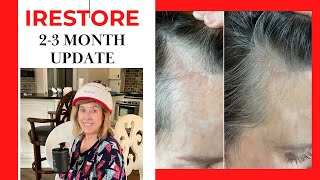 MY MOM'S 3 MONTH HAIR GROWTH UPDATE | IRESTORE LOW LASER HAIR THERAPY by The Glam Belle 2,036 views 1 year ago 9 minutes, 35 seconds