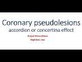 Coronary pseudolesions accordion or concertina effect