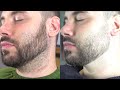 TUTORIAL: CÓMO ARREGLAR UNA BARBA CORTA (PASO A PASO)