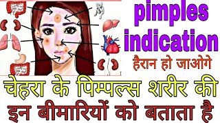 पिम्पल्स क्या बताना चाहते हैं शरीर क बारे में/ modicare products/ jyoti rawat/ rishikesh