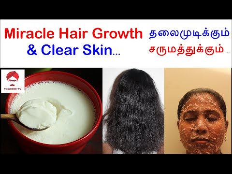 Yogurt Miracle hair growth and Clear skin || Curd benefits for health in  Tamil || - YouTube
